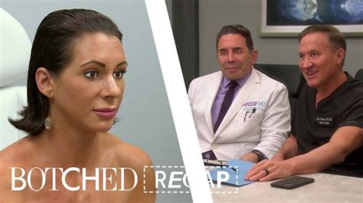 Botched Recap 8/17/14: Season 1 Finale “Silicone Valley”